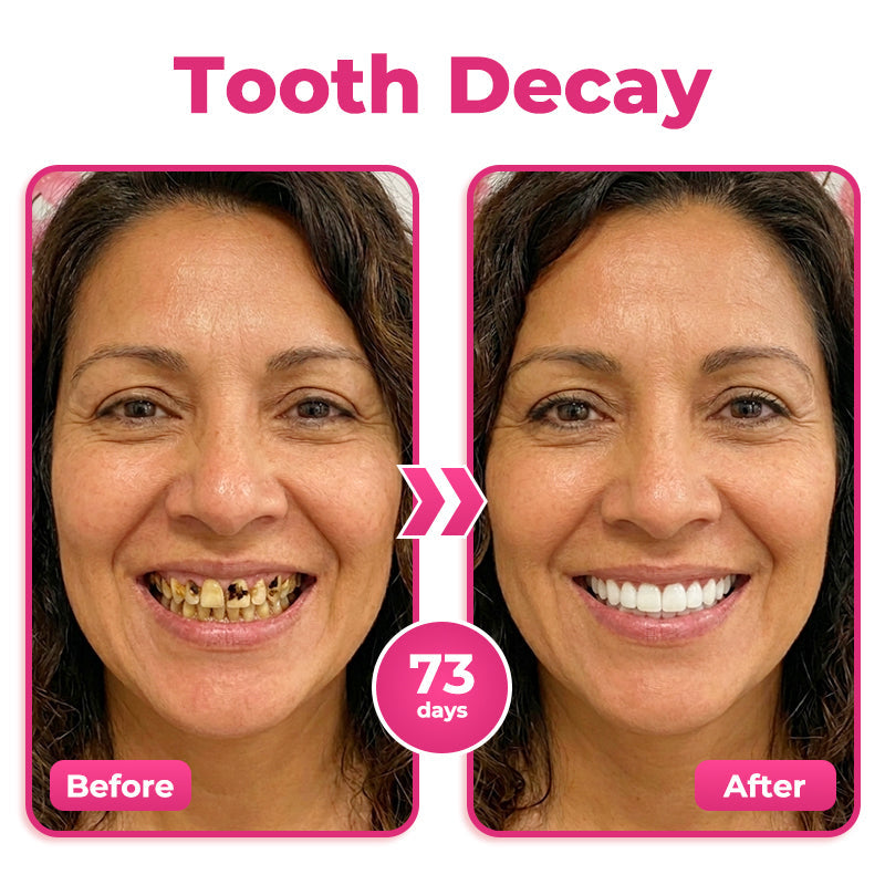 🇨🇦 😁 Natravor® Thismile NH-10 Toothpaste Serum for Enamel & Gum Care – Advanced Therapy