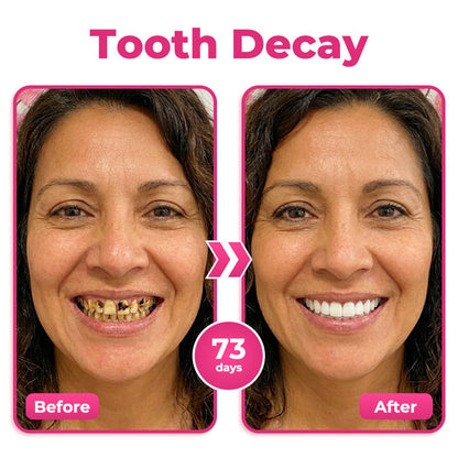 🇨🇦 😁 Natravor® Thismile NH-10 Toothpaste Serum for Enamel & Gum Care – Advanced Therapy