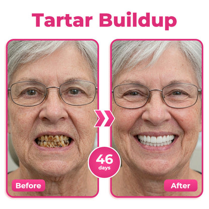 🇨🇦 😁 Natravor® Thismile NH-10 Toothpaste Serum for Enamel & Gum Care – Advanced Therapy