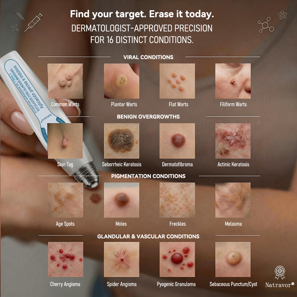 🇨🇦 Official Canada Store | Natravor® 7-Day Skin Tag & Blemish Roll-On – Painless & Scar-Free