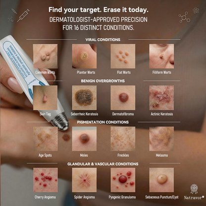 🇨🇦 Official Canada Store | Natravor® 7-Day Skin Tag & Blemish Roll-On – Painless & Scar-Free