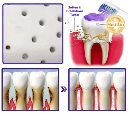 🦷𝐍𝐚𝐭𝐫𝐚𝐯𝐨𝐫® VioCore Bee Venom Gingivitis & Periodontitis Treatment Toothpaste